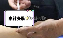 用注射器打水放屁眼里有多疼：真實體驗解析