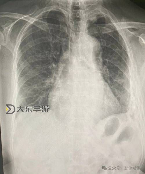 我想看胸片曝光2024今日更新:最新內(nèi)容全速獻(xiàn)上圖1