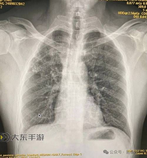【推薦】100%胸片曝光率免費無病毒動漫，安心觀看無憂！圖1