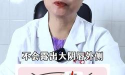 正常陰唇的樣子照片視頻：詳盡展示女性陰部自然美的真實圖片與視頻